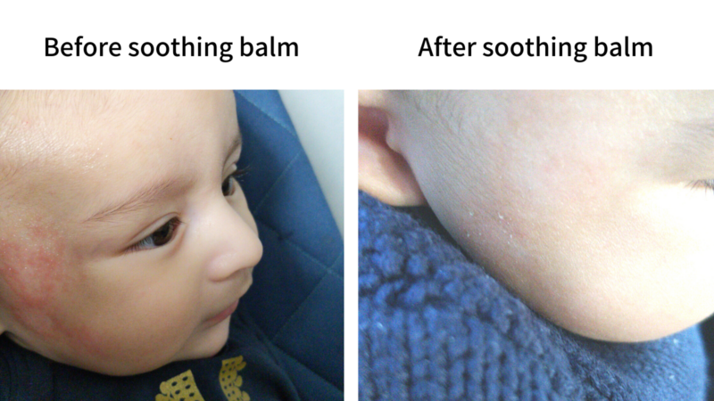 Soothing Balm - Image 3